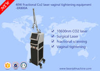 оборудование лазера СО2 40в частичное/коммерчески влагалищное затягивая оборудование