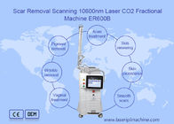 частичная машина лазера СО2 10600nm для Resurfacing кожи