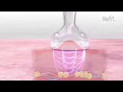 Вакуума кавитации MLS05 целлюлит RF портативного 40K ультразвуковой уменьшает прибор