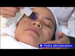CV07 4IN1 Face Suction Photon Rejuvenation Кислородное отбеливающее устройство для лица
