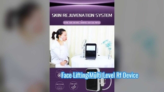 Неинвазивный радиочастотный прибор для ухода за глазами 60 Вт, ровные тонкие линии, многоуровневый
