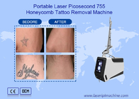 Прибор 755nm 1064nm 532nm машины удаления татуировки лазера пикосекунды Nd Yag