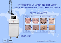 755nm машина удаления татуировки лазера пикосекунды Nd Yag