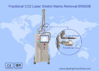 Машина лазера СО2 сканирования 10600nm 10x10mm удаления шрама частичная