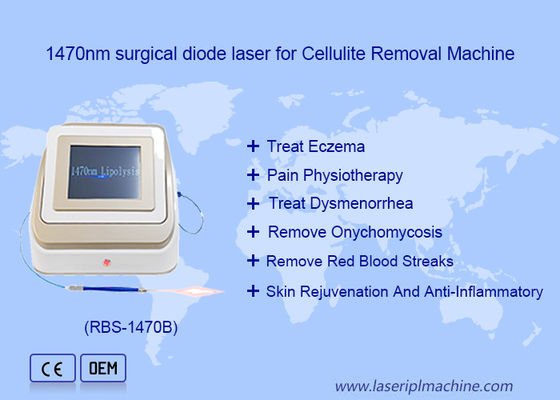 Хорошая цена 1470nm 980nm Диодный лазерный липолиз Хирургия Лазерное устройство Растворимый в жире онлайн